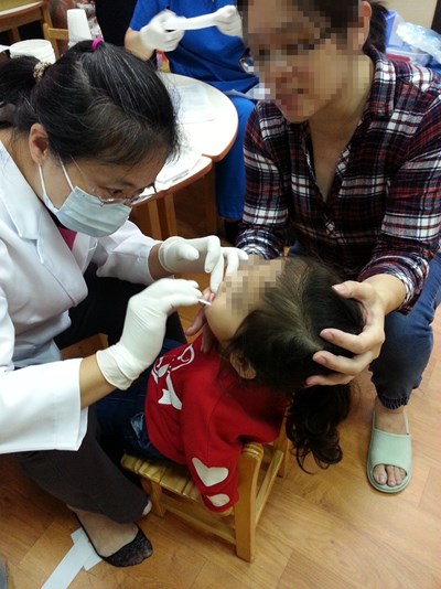 預防兒童蛀牙  中市衛生局籲塗氟填溝不可少